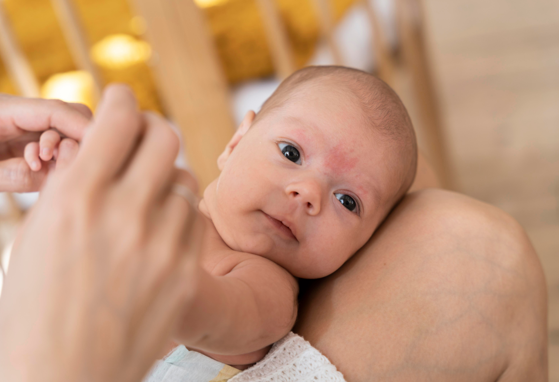 Акне у новонароджених: причини та лікування